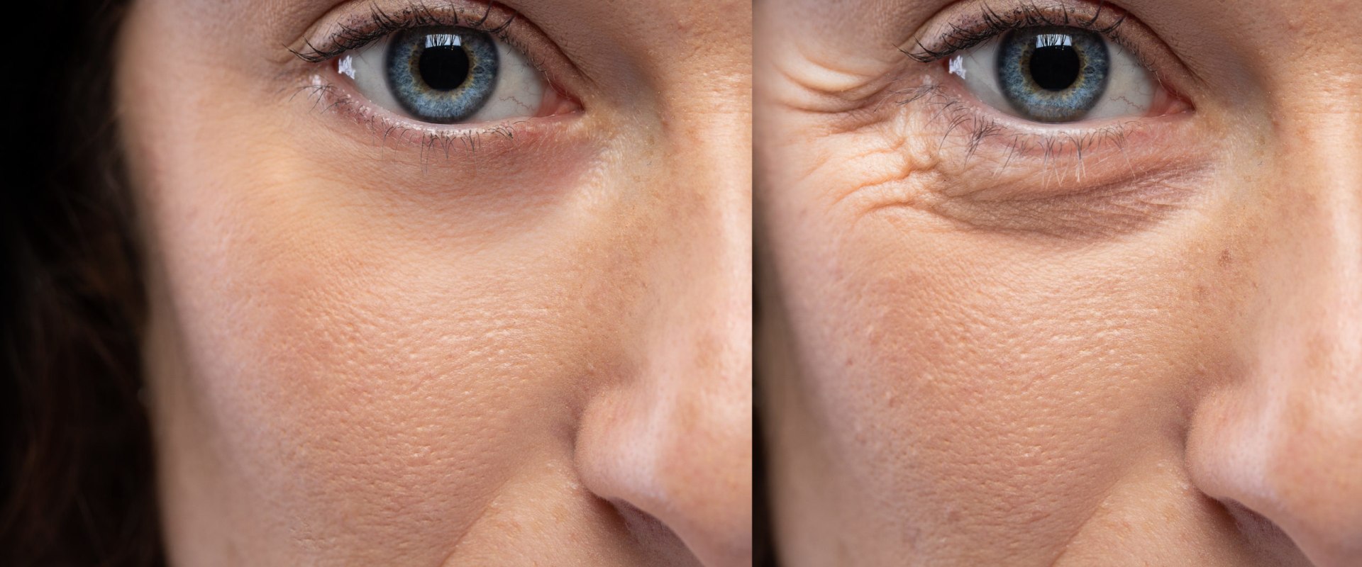 Which lasts longer: dysport or botox?