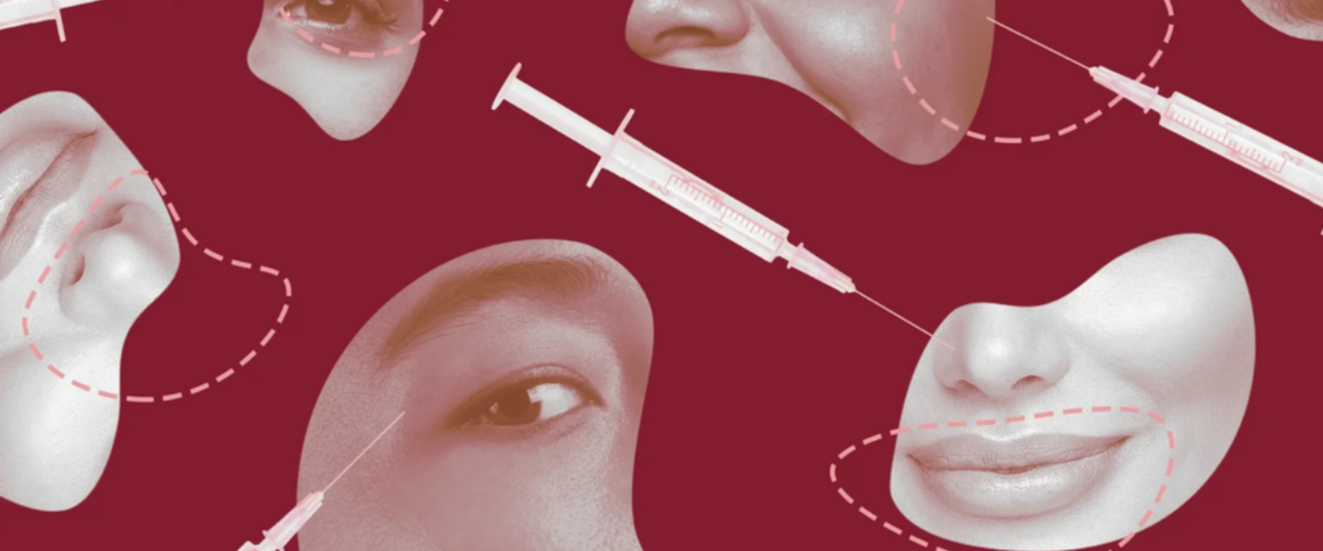 Does Botox or Dysport Last Longer?