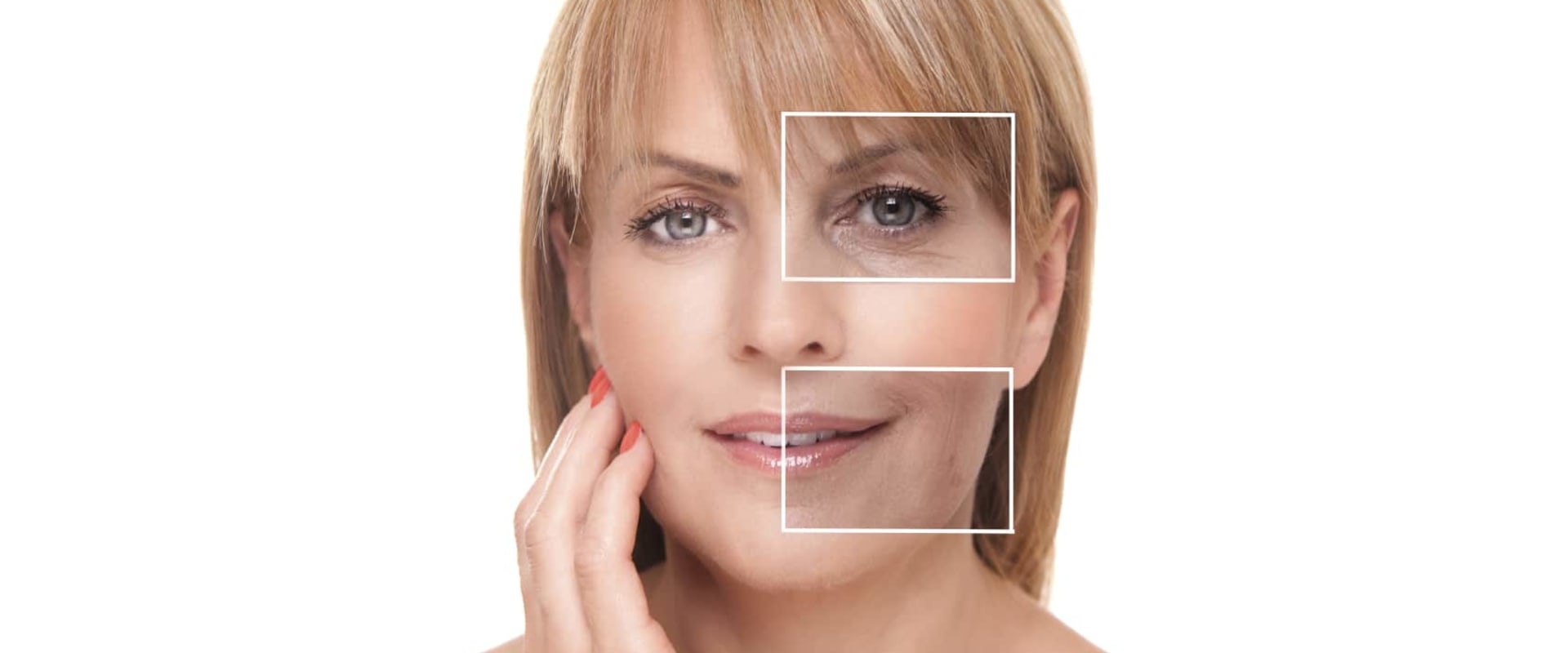 Get the best results from dysport injections