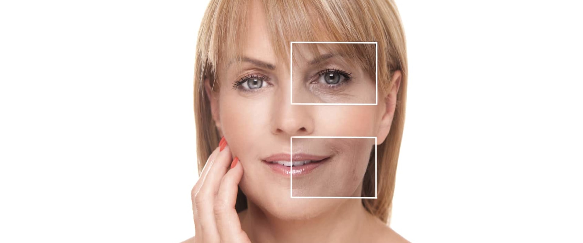 Get the Best Results from Dysport Injections