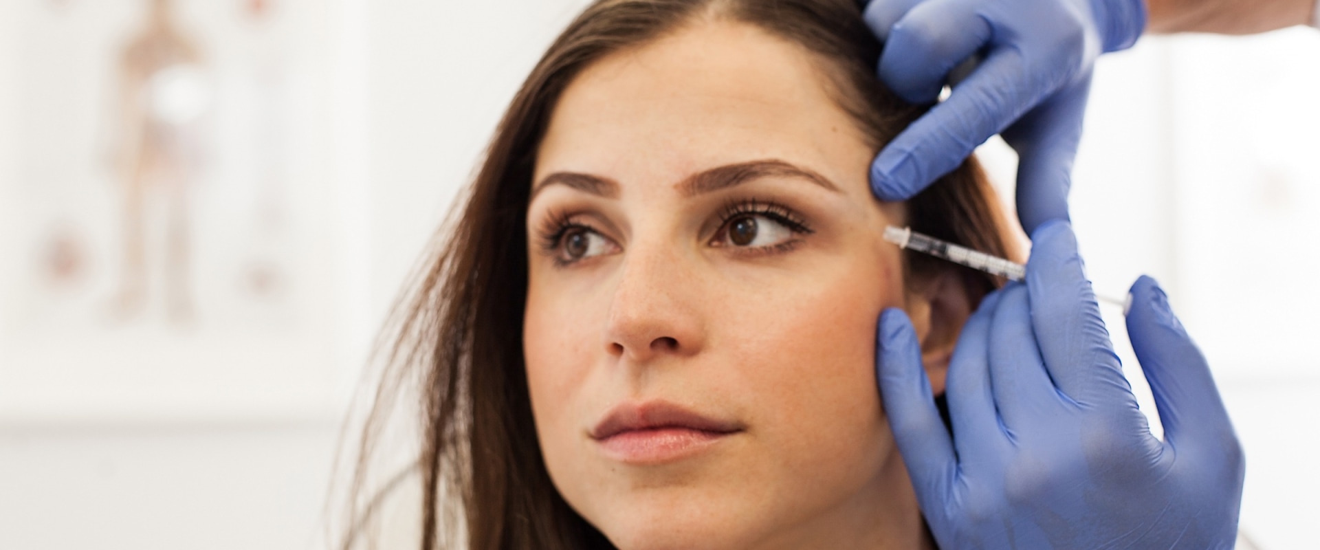 When do dysport side effects disappear?