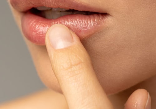 Can dysport help you achieve the perfect lip flip?