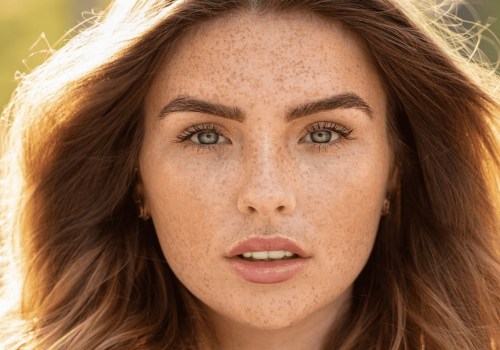 How Long Does Dysport Last? Expert Advice on Botox and Dysport Injections