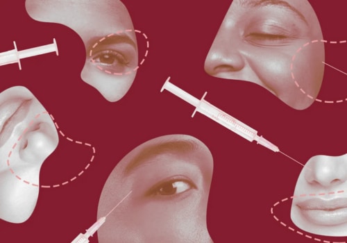 Does Botox or Dysport Last Longer?