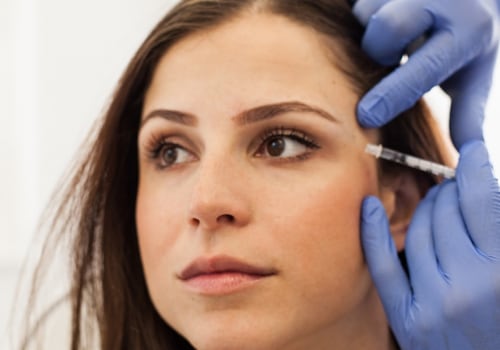 When do Dysport Side Effects Disappear?