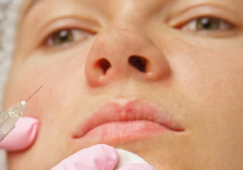 What to do after dysport injections?